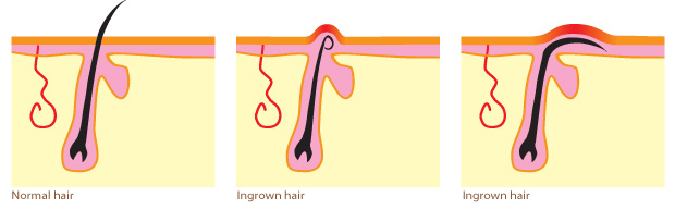 hair-diagram
