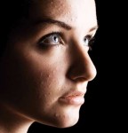 Skintervention 101: Acne Habits to Break and Prevent