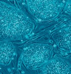Stem Cells: What and Why