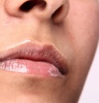 Inflammation: The Common Thread