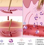 10 Things About... Inflammation