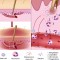 10 Things About... Inflammation