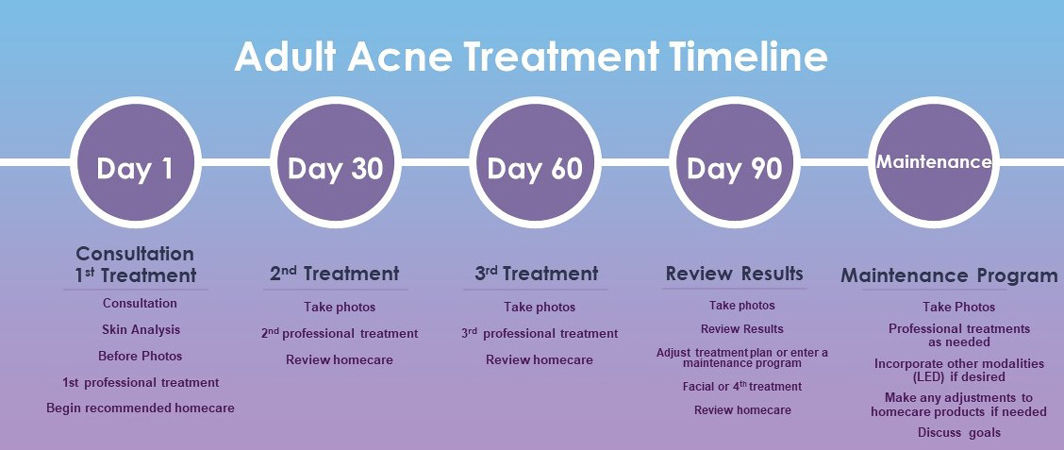 adult acne timeline 