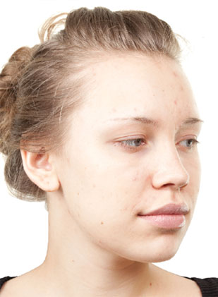girl1