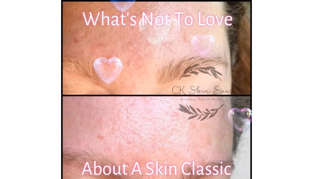 Skin Classics by RN Faces