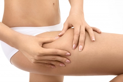 Smooth Moves: 6 Treatment Options for Cellulite