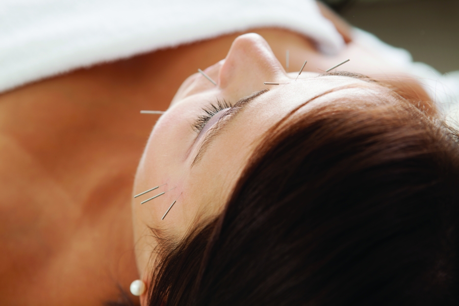 Beauty From Within: Cosmetic Facial Acupuncture