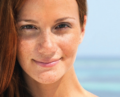 How Sun Damage Presents in the Skin