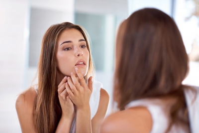 One Step Closer to the Holy Grail of Acne Care