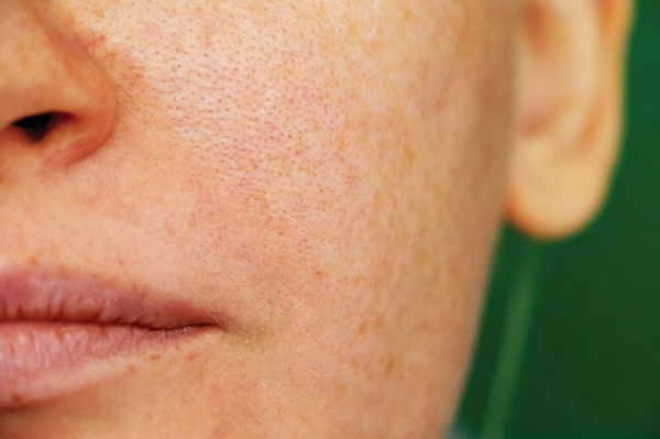 Fact or Fiction: Open pores are actually better.