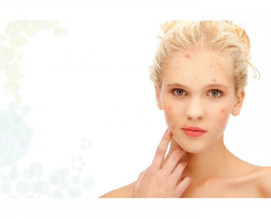 Natural versus synthetic Acne Solutions