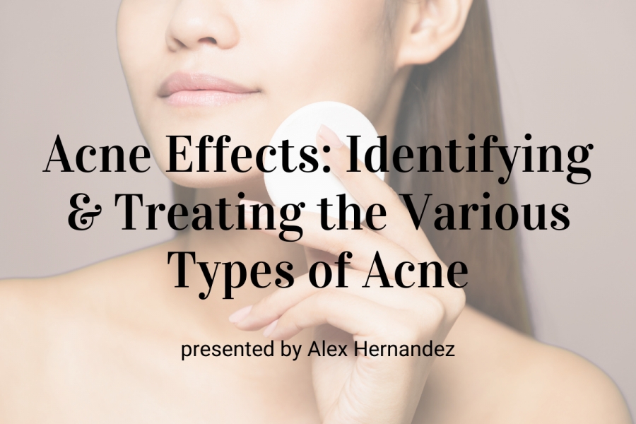 Webinar: Acne Effects: Identifying &amp; Treating the Various Types of Acne