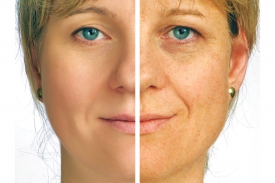 Fact or Fiction: Most sun damage accumulates before the age of 18.