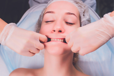 Nonsurgical Rejuvenation: Buccal Facial Massage
