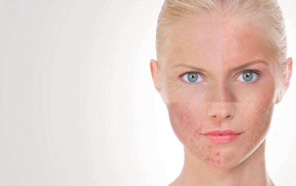 Underlying Causes of Sensitive Skin: Analyzing Internal and External Factors
