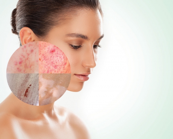 Distinguishing Between Skin Diseases Aestheticians Need to Recognize