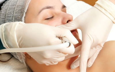 Thinking of Adding a New Service to Your Menu?  Try Microdermabrasion