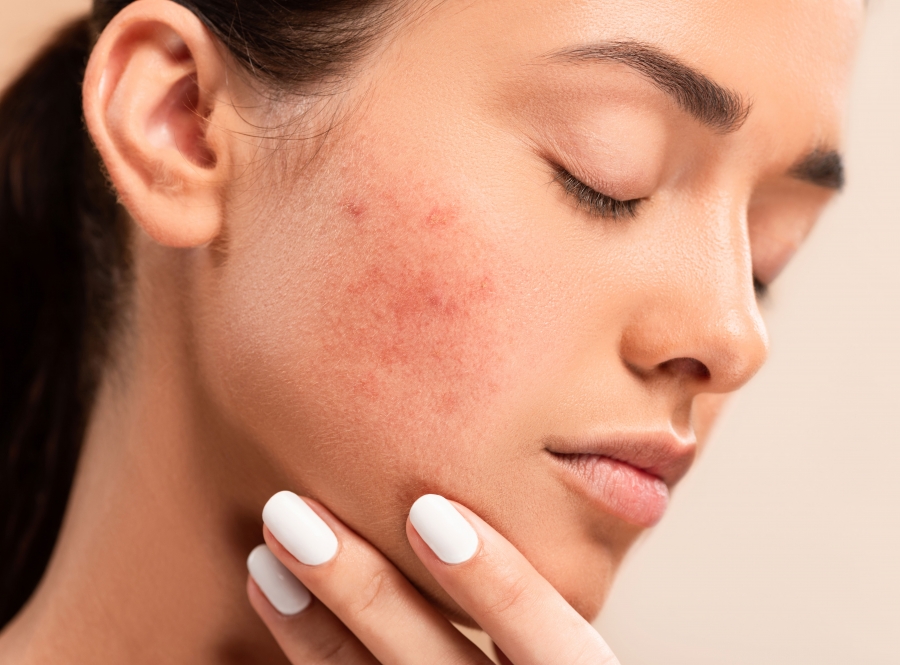 Dermatitis Detection: Recognizing &amp; Managing Afflicted Skin