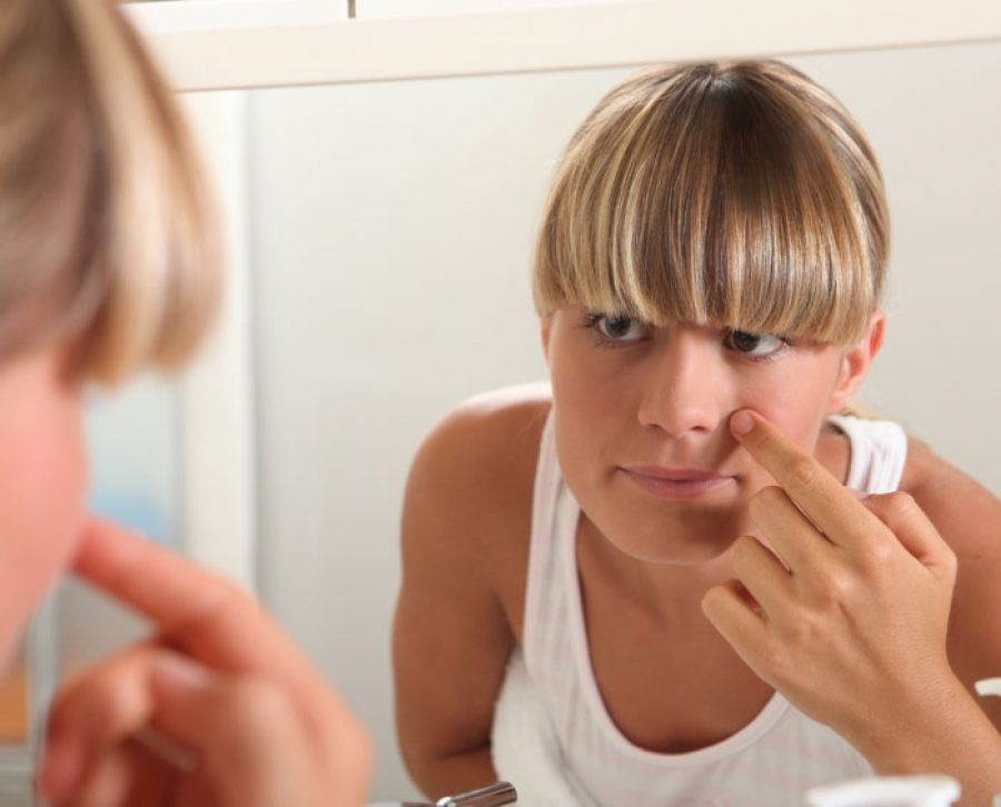 The Psychology of Treating Teen Acne