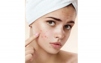 2015 Acne Products