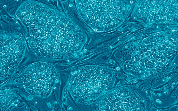 Stem Cells: What and Why