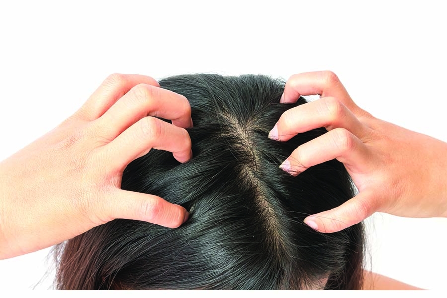 Scratching the Surface on Itchy Scalp Solutions