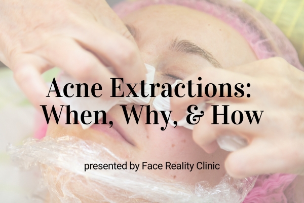 Webinar: Acne Extractions: When, Why, &amp; How