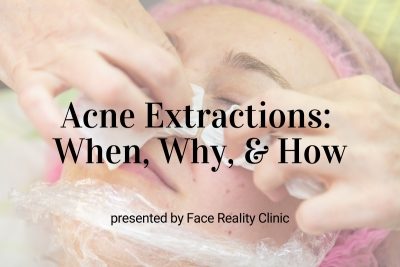Webinar: Acne Extractions: When, Why, & How