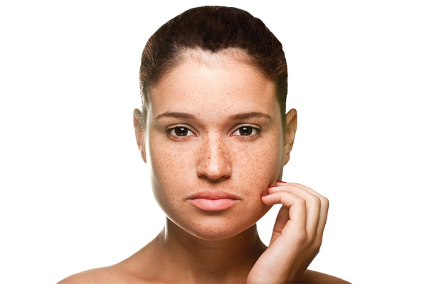 Better Together: Working with Dermatologists to Heal Hyperpigmentation