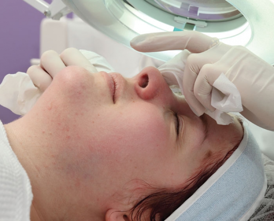Mastering the Treatment of Acneic Skin