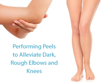 Performing Peels to Alleviate Dark, Rough Elbows and Knees