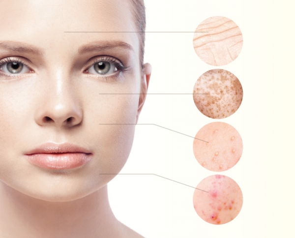 The Effects of Hormones on the Skin