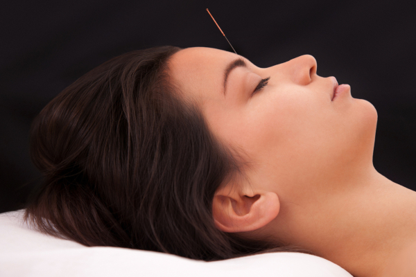 Acuperfect: The Benefits of Cosmetic Acupuncture