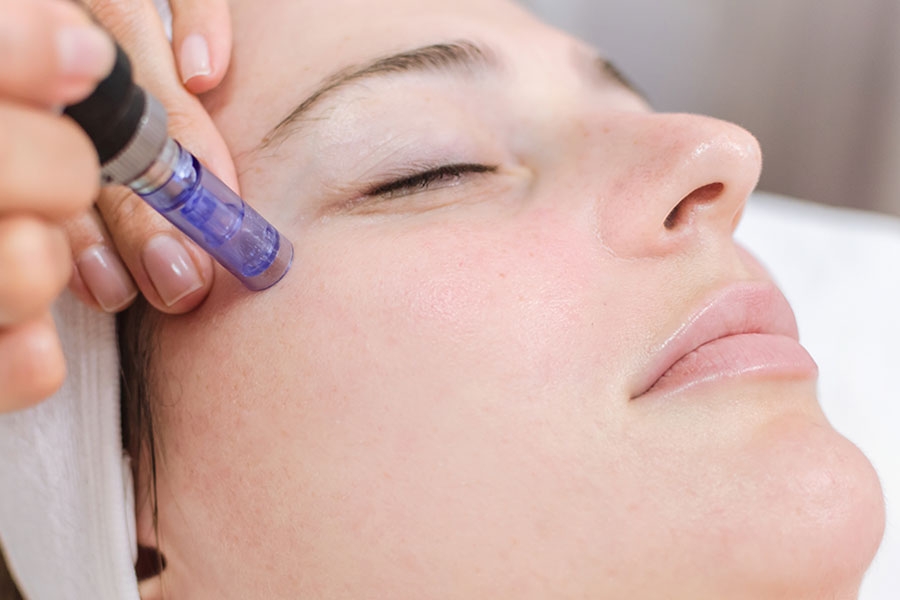 Microneedling &amp; Microinfusion: Contrasts and Optimization