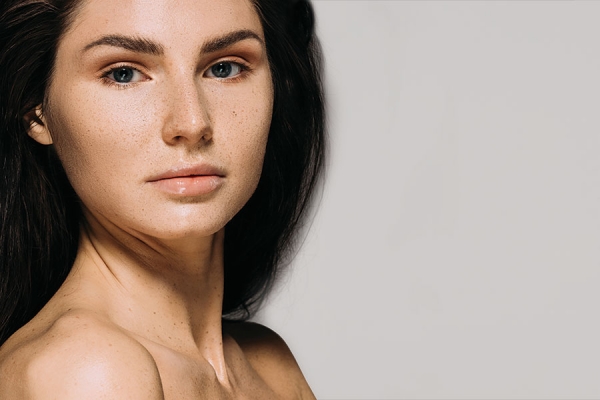 Hyperpigmentation: Are You Asking the Right Questions?