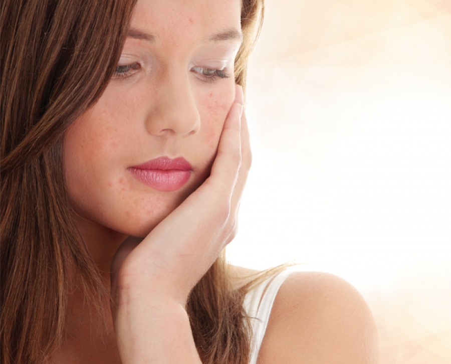 The Emotional Aspect of Treating Skin Conditions