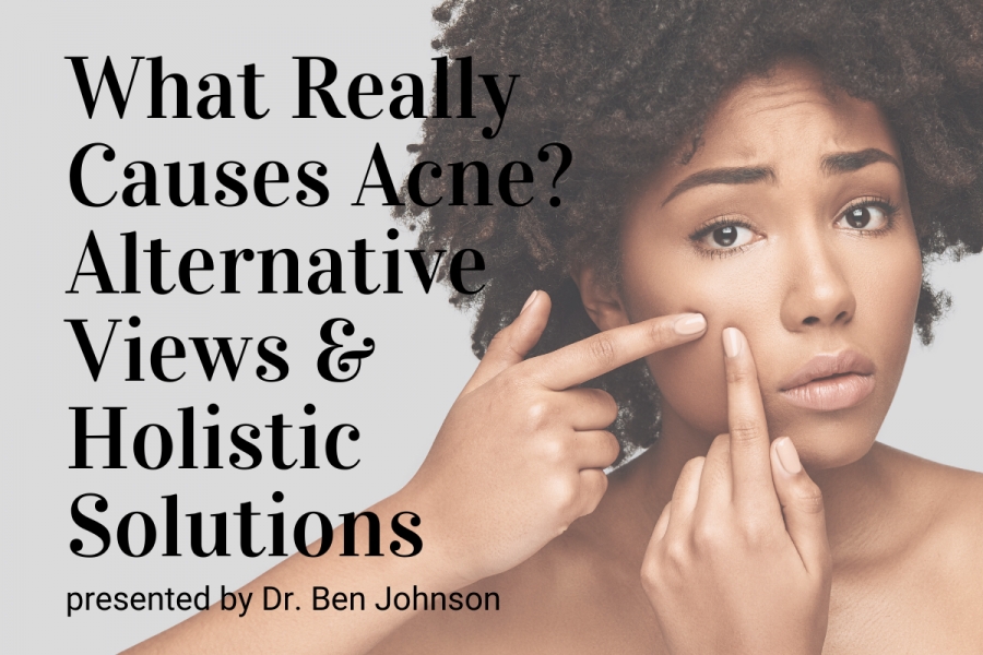 What Really Causes Acne?