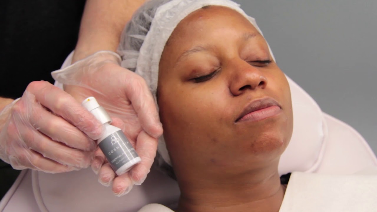 Essential Peptide Peel