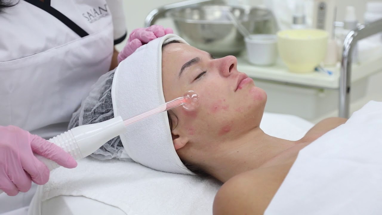 Saian Acne treatment using natural products and a high frequency machine