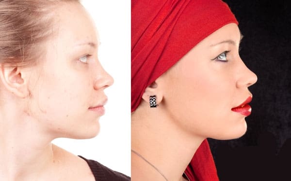 Easy and Effective Cover-Up for All Skin Discolorations