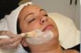 Step 2 - Resurfacing