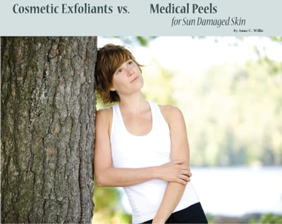 Cosmetic Exfoliants vs. Medical Peels for Sun Damaged Skin