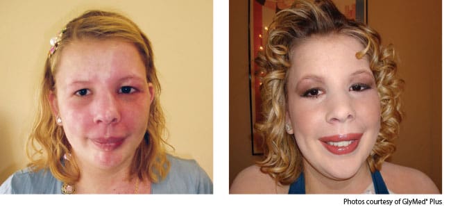 before-and-after