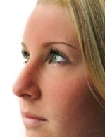 Effects of Rosacea Beyond Appearance