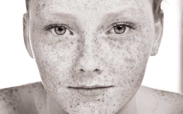 How to Bolster Skin Protection and Reverse the Effects of Photoaging