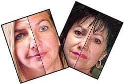 beautiful-image bott-left