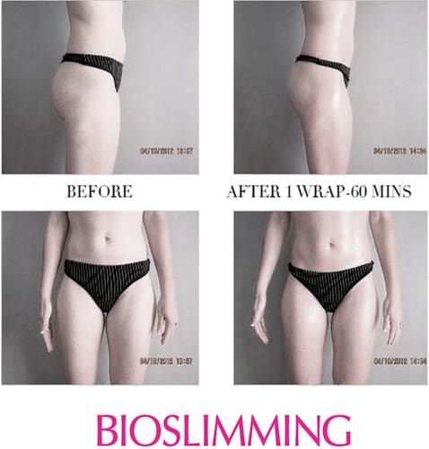 provence bioslimming