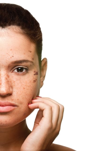 All Spots Are Not Created Equal