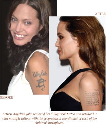 before-after