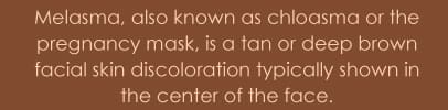 melasma